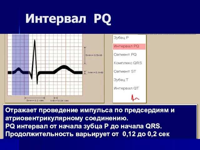 Интервал PQ Отражает проведение импульса по предсердиям и атриовентрикулярному соединению.