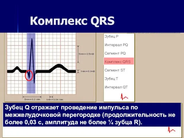 Комплекс QRS Зубец Q отражает проведение импульса по межжелудочковой перегородке (продолжительность не более