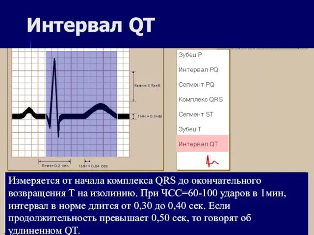Интервал QT Измеряется от начала комплекса QRS до окончательного возвращения