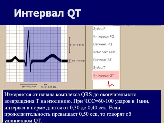 Интервал QT Измеряется от начала комплекса QRS до окончательного возвращения Т на изолинию.