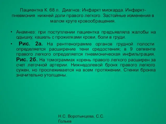 Н.С. Воротынцева, С.С. Гольев Рентгенопульмонология Пациентка К. 68 л. Диагноз: