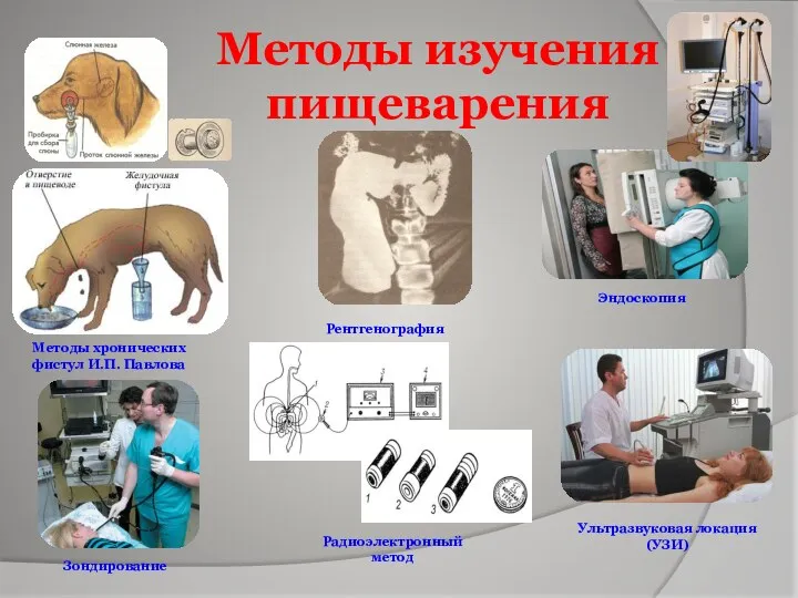 Методы изучения пищеварения Методы хронических фистул И.П. Павлова Рентгенография Эндоскопия Ультразвуковая локация (УЗИ) Зондирование Радиоэлектронный метод