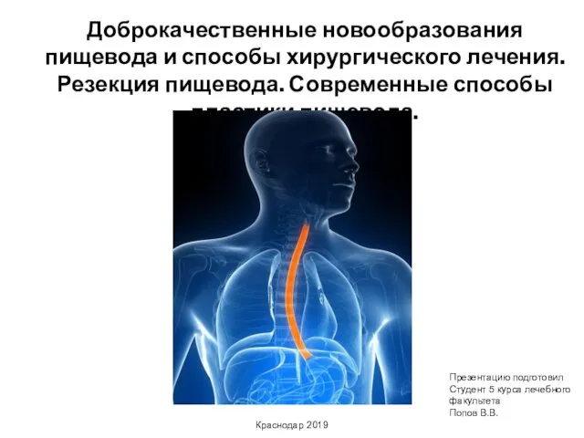 Доброкачественные новообразования пищевода и способы хирургического лечения. Резекция пищевода. Современные