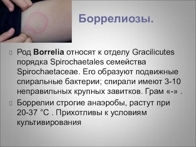 Боррелиозы. Род Borrelia относят к отделу Gracilicutes порядка Spirochaetales семейства Spirochaetaceae. Его образуют