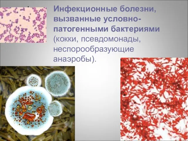 Инфекционные болезни, вызванные условно-патогенными бактериями (кокки, псевдомонады, неспорообразующие анаэробы).