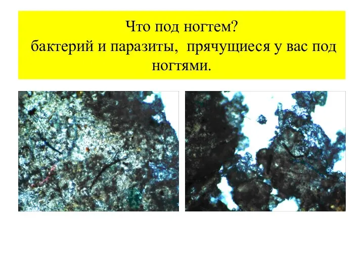 Что под ногтем? бактерий и паразиты, прячущиеся у вас под ногтями.