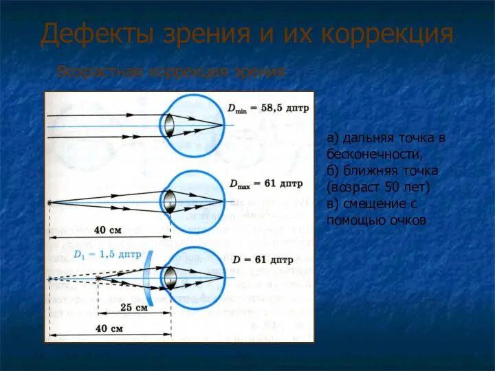 Дефекты зрения и их коррекция Возрастная коррекция зрения а) дальняя точка в бесконечности,