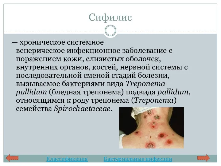 Сифилис — хроническое системное венерическое инфекционное заболевание с поражением кожи,