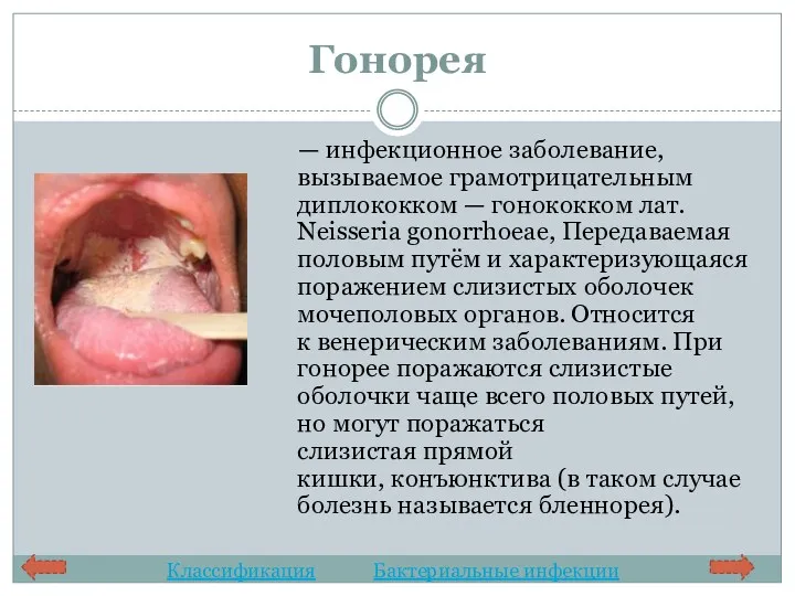 Гонорея — инфекционное заболевание, вызываемое грамотрицательным диплококком — гонококком лат. Neisseria gonorrhoeae, Передаваемая