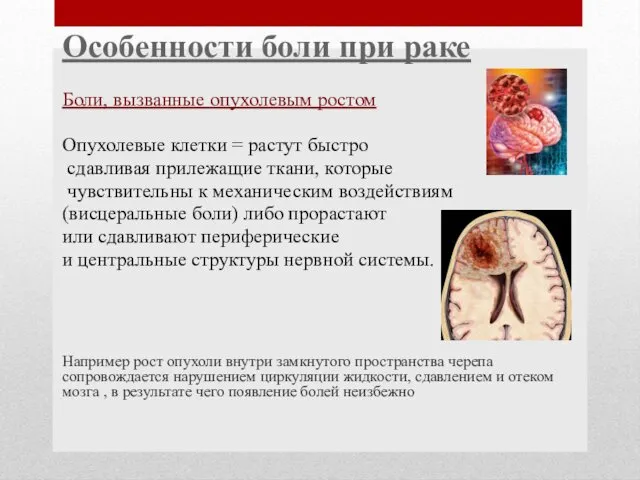 Особенности боли при раке Боли, вызванные опухолевым ростом Опухолевые клетки = растут быстро