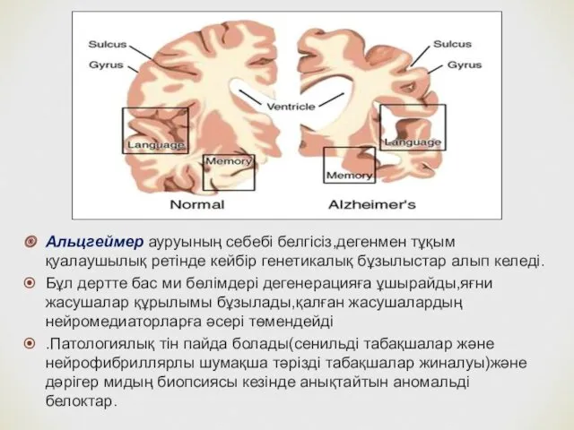 Альцгеймер ауруының себебі белгісіз,дегенмен тұқым қуалаушылық ретінде кейбір генетикалық бұзылыстар