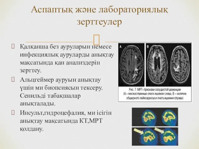 Қалқанша без ауруларын немесе инфекциялық ауруларды анықтау мақсатында қан анализдерін