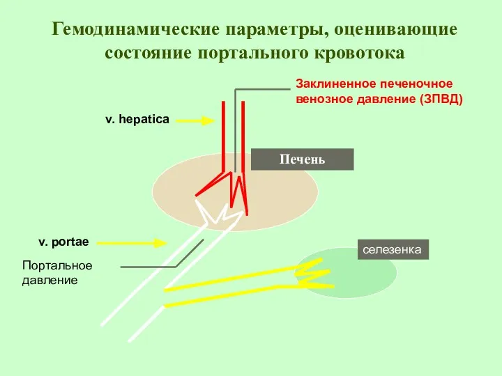 Гемодинамические параметры, оценивающие состояние портального кровотока Печень v. hepatica v. portae селезенка Заклиненное