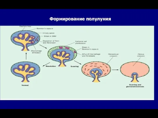 Формирование полулуния