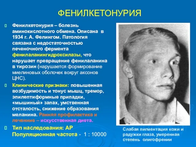 ФЕНИЛКЕТОНУРИЯ Фенилкетонурия – болезнь аминокислотного обмена. Описана в 1934 г.