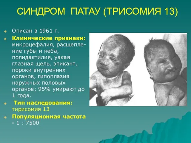 СИНДРОМ ПАТАУ (ТРИСОМИЯ 13) Описан в 1961 г. Клинические признаки: