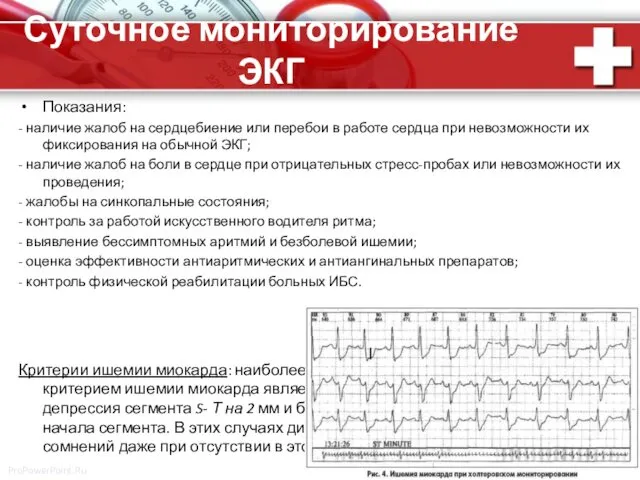 Суточное мониторирование ЭКГ Показания: - наличие жалоб на сердцебиение или
