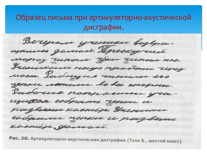 Образец письма при артикуляторно-акустической дисграфии.