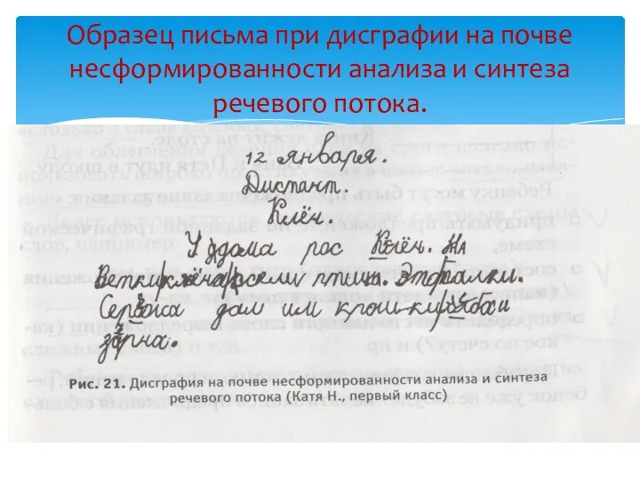 Образец письма при дисграфии на почве несформированности анализа и синтеза речевого потока.