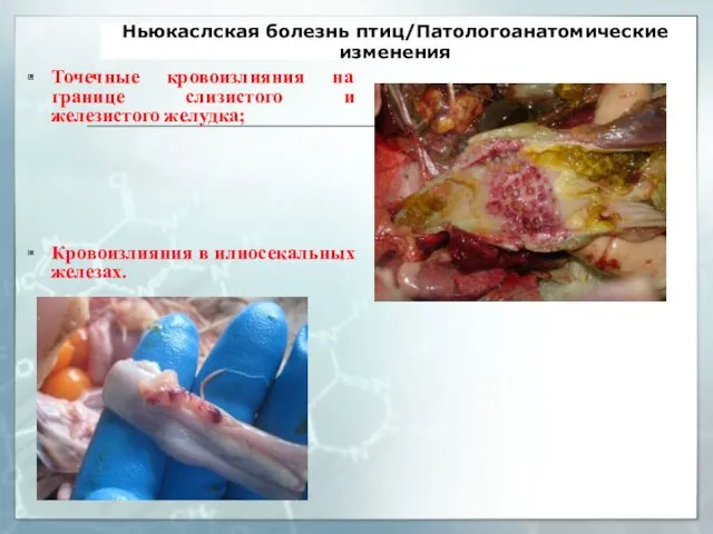 Ньюкаслская болезнь птиц/Патологоанатомические изменения Точечные кровоизлияния на границе слизистого и железистого желудка; Кровоизлияния в илиосекальных железах.
