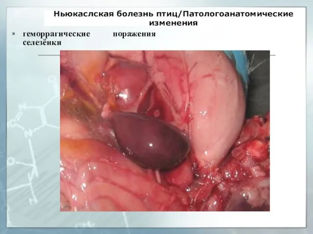 Ньюкаслская болезнь птиц/Патологоанатомические изменения геморрагические поражения селезёнки