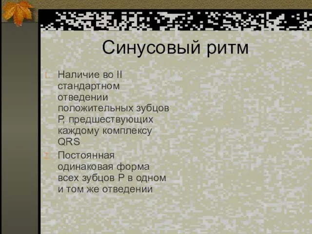 Синусовый ритм Наличие во II стандартном отведении положительных зубцов Р,