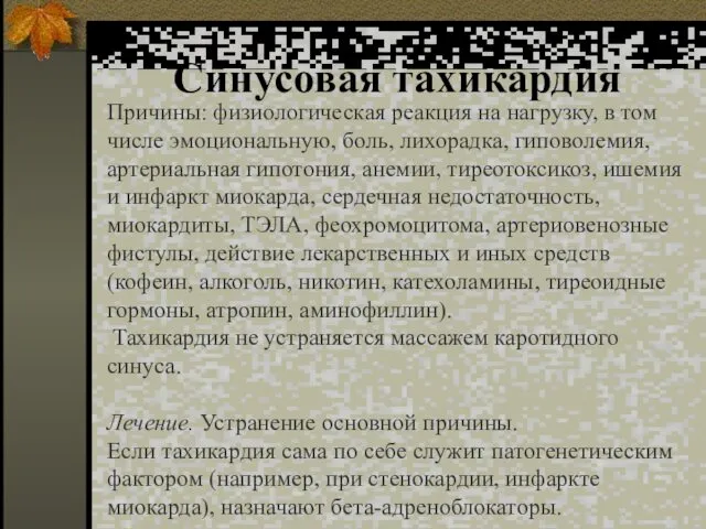 Синусовая тахикардия Причины: физиологическая реакция на нагрузку, в том числе