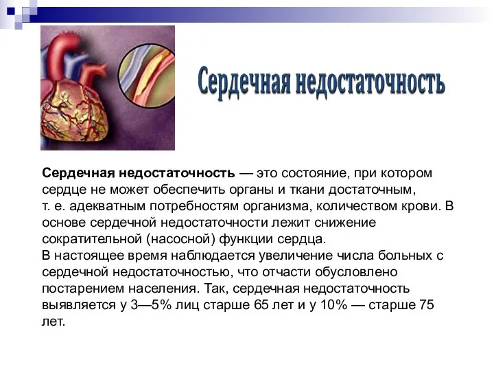 Сердечная недостаточность — это состояние, при котором сердце не может