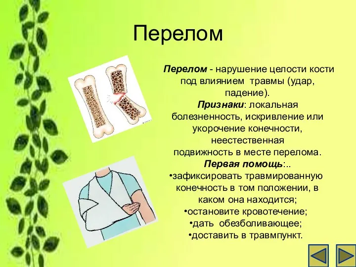 Перелом Перелом - нарушение целости кости под влиянием травмы (удар,