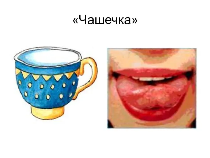 «Чашечка»