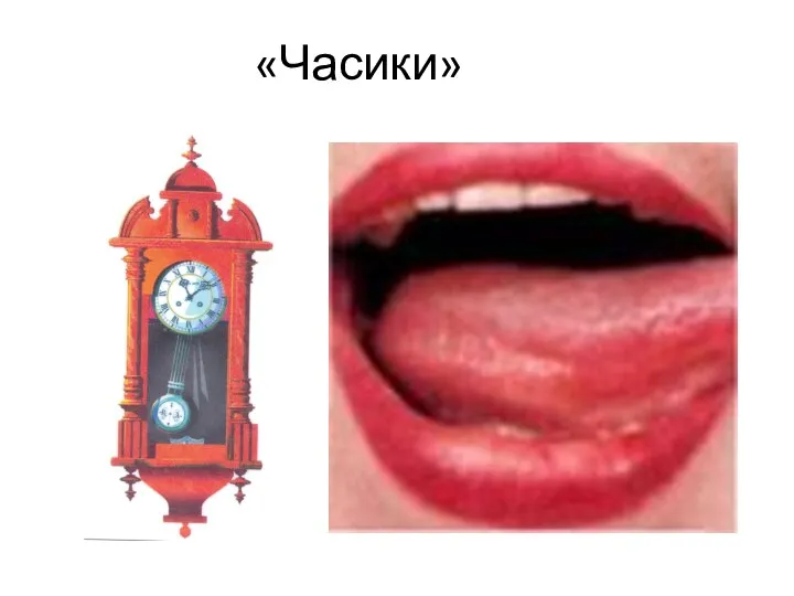 «Часики»