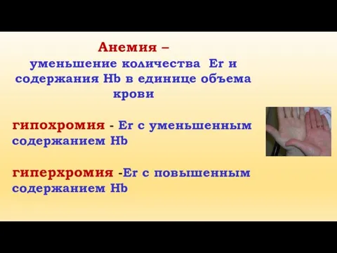 Анемия – уменьшение количества Er и содержания Hb в единице