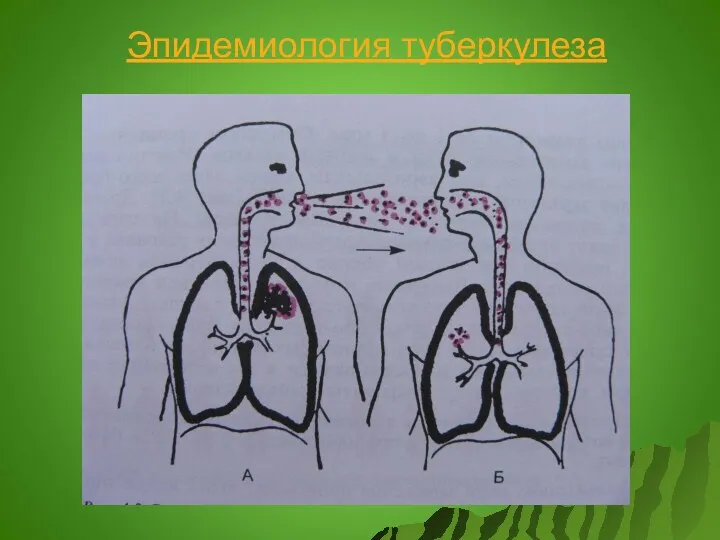 Эпидемиология туберкулеза