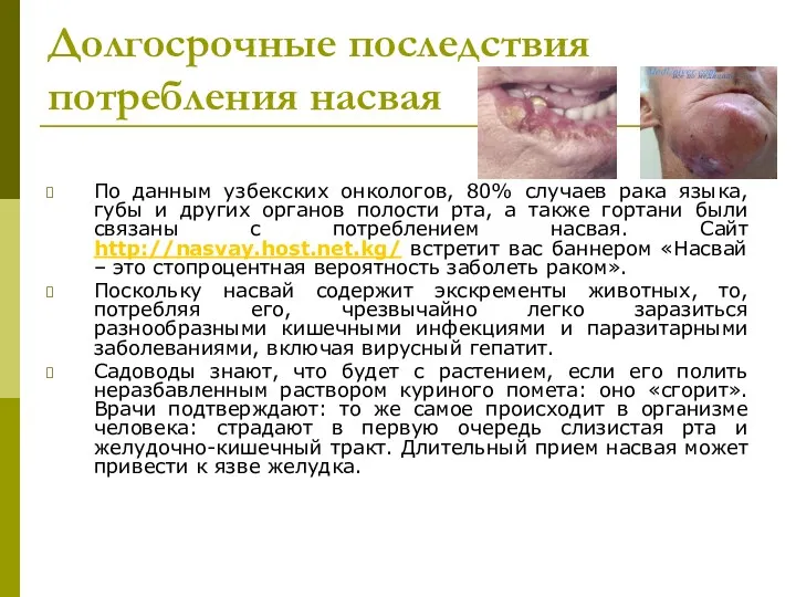 Долгосрочные последствия потребления насвая По данным узбекских онкологов, 80% случаев
