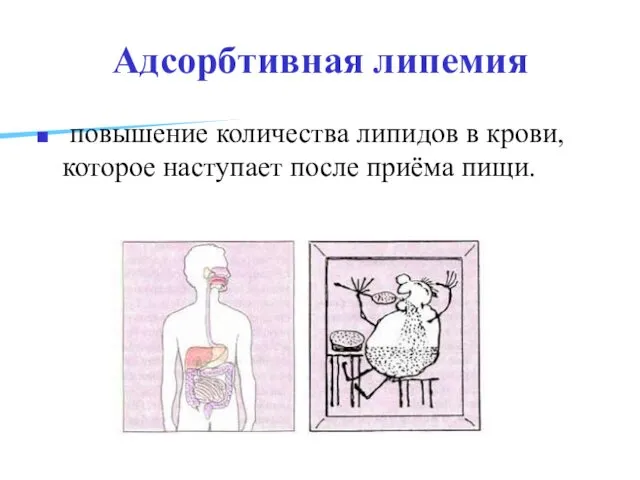 Адсорбтивная липемия повышение количества липидов в крови, которое наступает после приёма пищи.