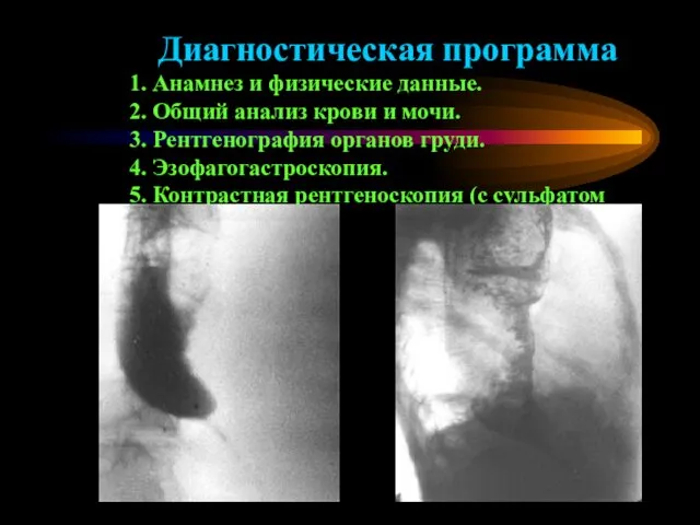 Диагностическая программа 1. Анамнез и физические данные. 2. Общий анализ