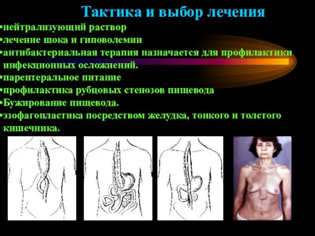 Тактика и выбор лечения нейтрализующий раствор лечение шока и гиповолемии