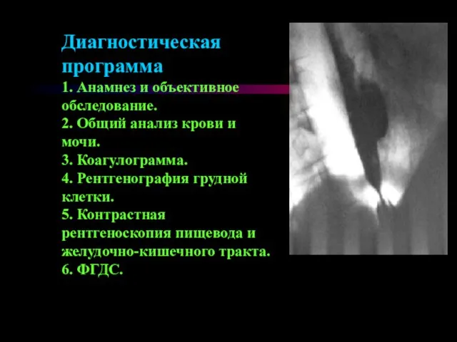 Диагностическая программа 1. Анамнез и объективное обследование. 2. Общий анализ