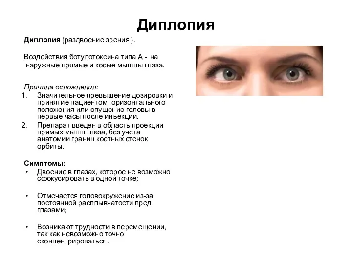 Диплопия Диплопия (раздвоение зрения ). Воздействия ботулотоксина типа А -