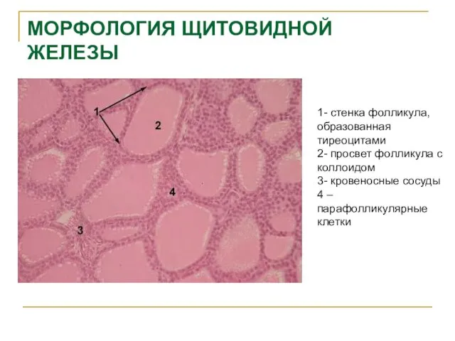 МОРФОЛОГИЯ ЩИТОВИДНОЙ ЖЕЛЕЗЫ 1- стенка фолликула, образованная тиреоцитами 2- просвет