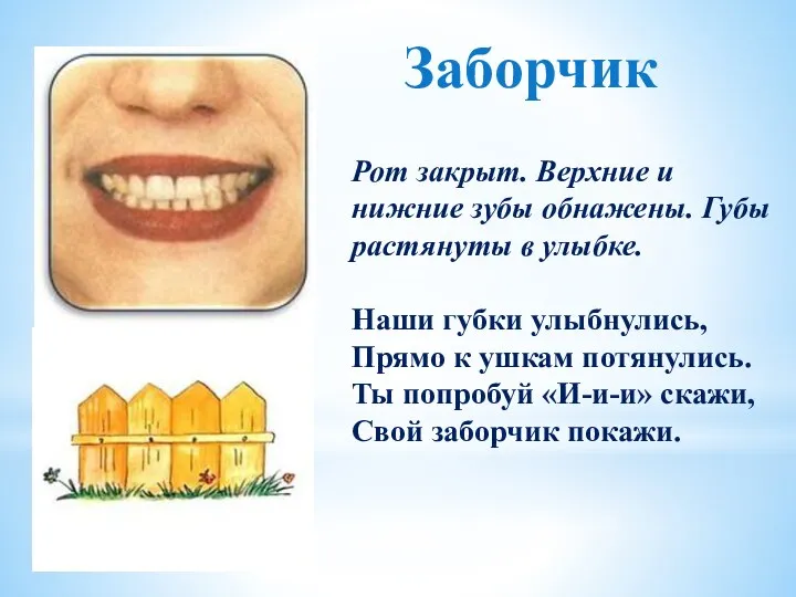 Рот закрыт. Верхние и нижние зубы обнажены. Губы растянуты в