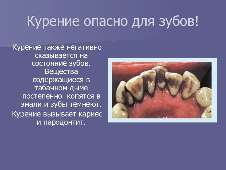 Курение опасно для зубов! Курение также негативно сказывается на состояние зубов. Вещества содержащиеся