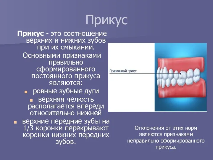 Прикус Прикус - это соотношение верхних и нижних зубов при их смыкании. Основными