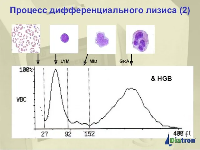 Процесс дифференциального лизиса (2) Процесс дифференциального лизиса (2) LYM MID GRA