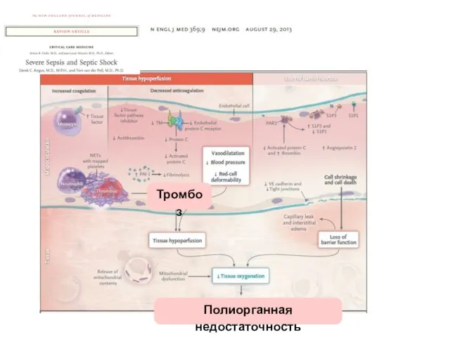 Тромбоз Полиорганная недостаточность