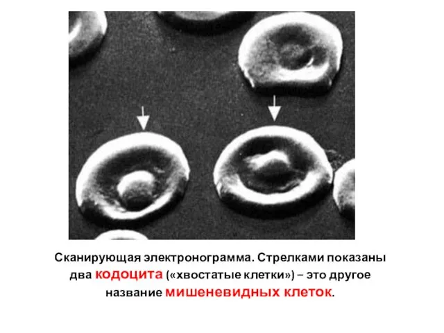 Сканирующая электронограмма. Стрелками показаны два кодоцита («хвостатые клетки») – это другое название мишеневидных клеток.