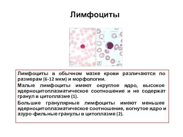 Лимфоциты Лимфоциты в обычном мазке крови различаются по размерам (6-12