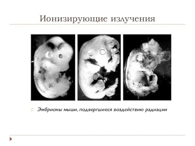 Ионизирующие излучения Эмбрионы мыши, подвергшиеся воздействию радиации
