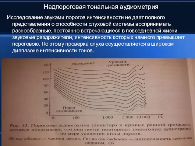 Надпороговая тональная аудиометрия Исследование звуками порогов интенсивности не дает полного