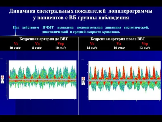Динамика спектральных показателей допплерограммы у пациентов с ВБ группы наблюдения